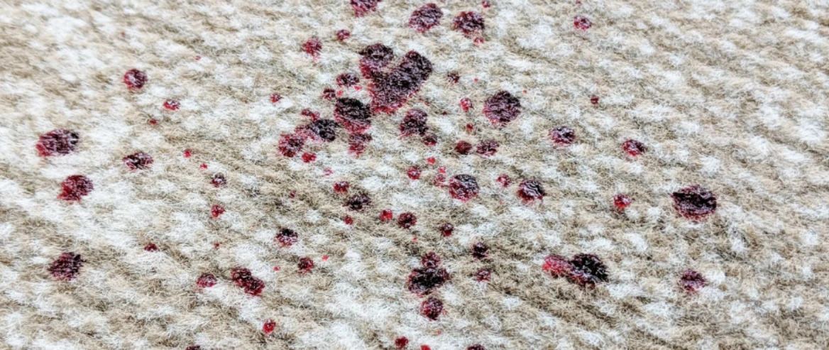 Removing blood stains from carpet - Afrand Carpet online store